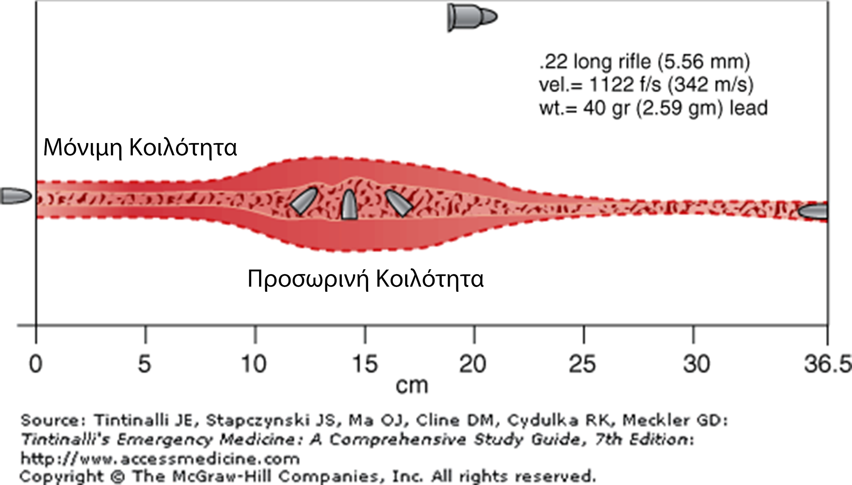 Wundballistik (Wound Ballistics)